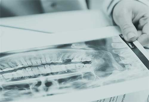 Chirurgia stomatologiczna — zdjęcie z obecnej strony Dr Marka Rybickiego